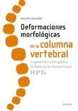 DEFORMACIONES MORFOLÓGICAS DE LA COLUMNA VERTEBRAL